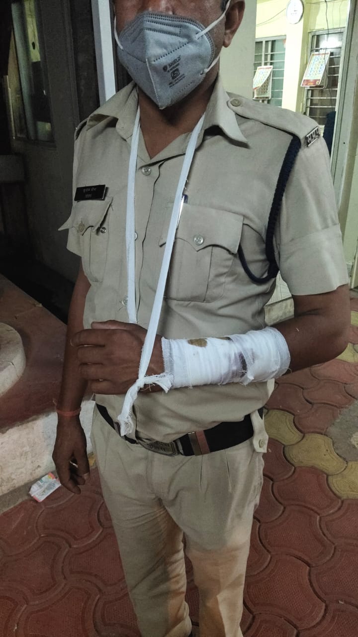 MP में असुरक्षित पुलिसकर्मी, लोगों ने किया ऐसा हाल