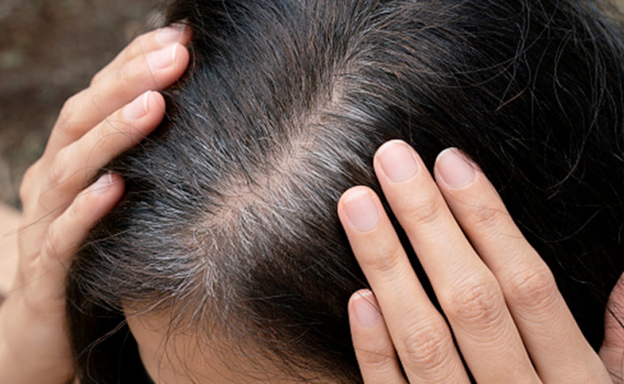 Hair Care Tips : सफ़ेद बालों से पाना चाहते है छुटकारा, तो अपनाएं घर पर बने 10 आसान नुस्खे