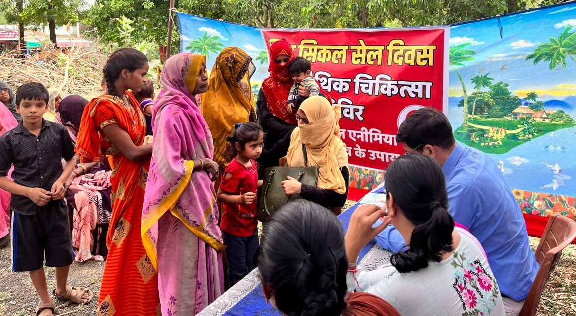 Indore: सिकल सेल एनीमिया मरीजों के बीच पहुंचे डॉ. द्विवेदी, जांच कर मरीजों को नि:शुल्क होम्योपैथिक दवा का किया वितरण
