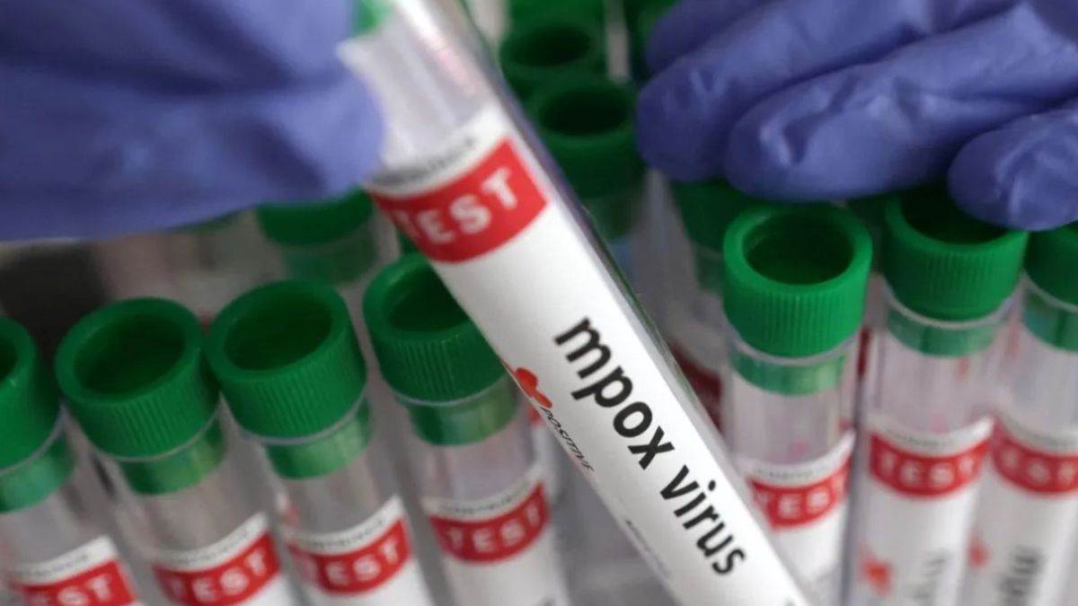 पहली Mpox वैक्सीन को WHO से मिली मंजूरी, सबसे पहले इन देशों में शुरू होगा टीकाकरण