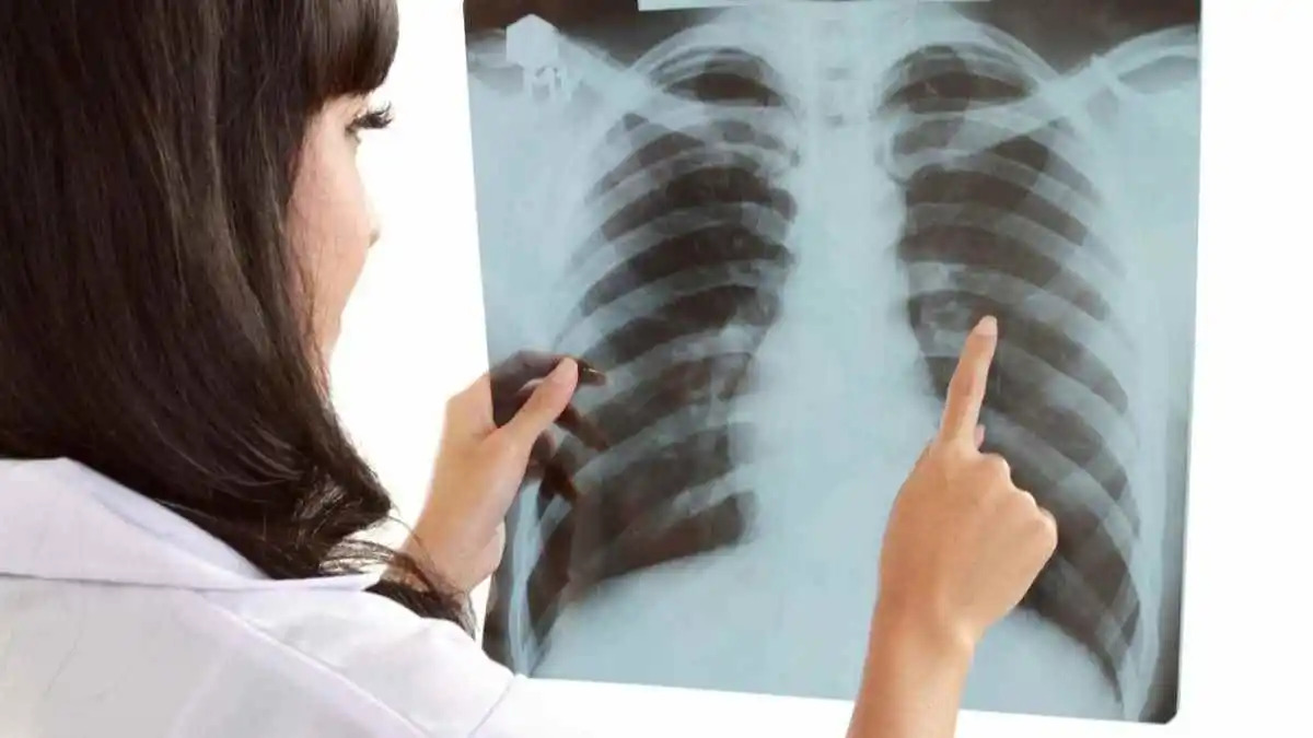 सिगरेट से दूर रहने वालों में Lung Cancer का बढ़ रहा खतरा, नई रिसर्च में आए चौंकाने वाले निष्कर्ष