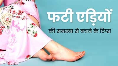 Health Care : सर्दियों में फटी एड़ियों से रहते हैं आप परेशान, तो ऐसे करें केयर