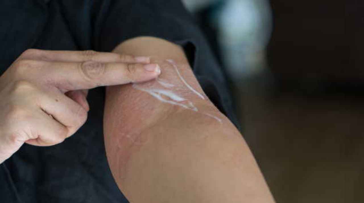 skin allergy