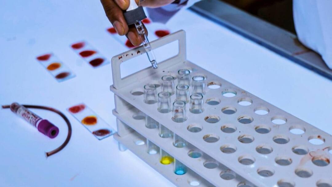 सतना घटना के बाद सख्त कदम, एमपी में लागू होगी नई ब्लड बैंक नीति, अब NAT जांच के बिना नहीं होगा रक्त आधान