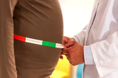 एमपी के सरकारी अस्पताल में शुरू हुआ पहला ओबेसिटी क्लिनिक, अब मुफ्त में मिलेगा मोटापे का इलाज