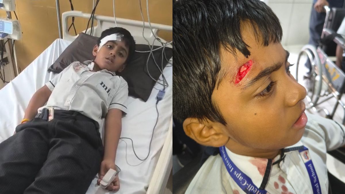 इंदौर के Medicaps School में दो छात्रों को लगी गंभीर चोट, अभिभावक ने स्कूल प्रबंधन पर लगाया लापरवाही का आरोप