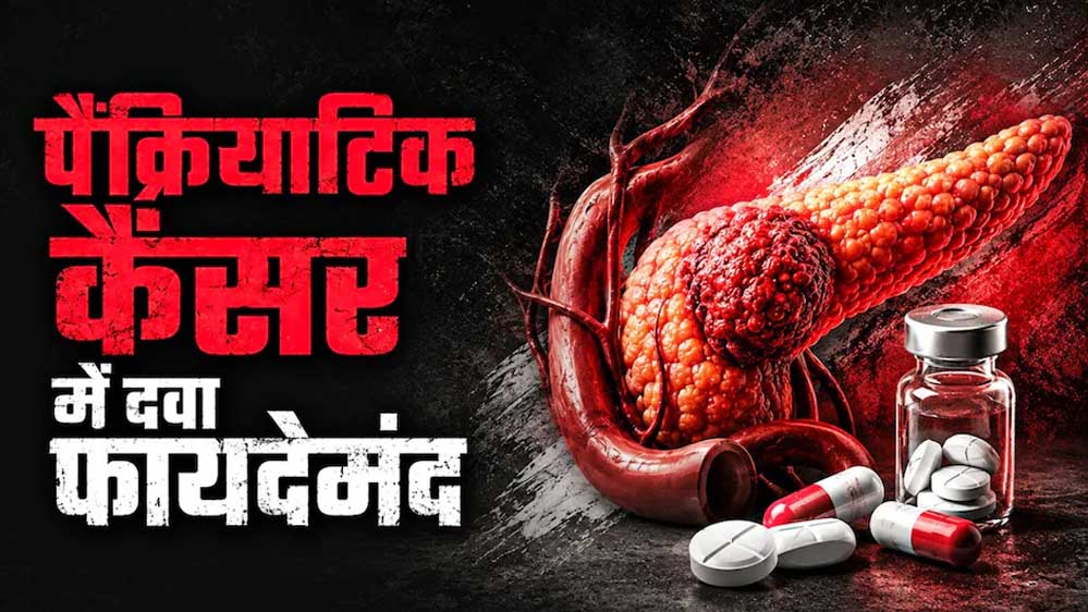 पैंक्रियाटिक कैंसर मरीजों के लिए बड़ी खबर, नई दवा ‘रासोंक’ को FDA की मंजूरी