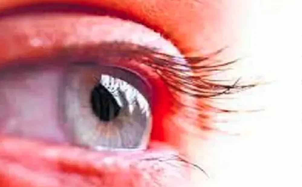 तीन नेत्रदान, छह कॉर्निया और चार बुजुर्गों की जिंदगी में लौटी रोशनी