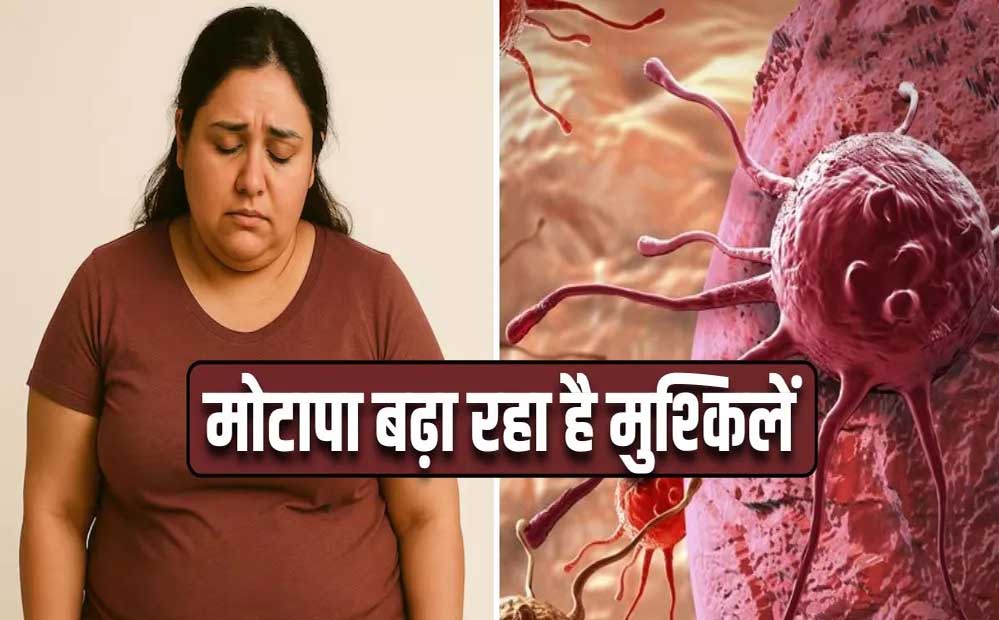 Cancer Alert: मोटापा और तनाव बना रहे बीमारी की वजह, पुरुषों में ओरल- महिलाओं में ब्रेस्ट कैंसर बढ़ा