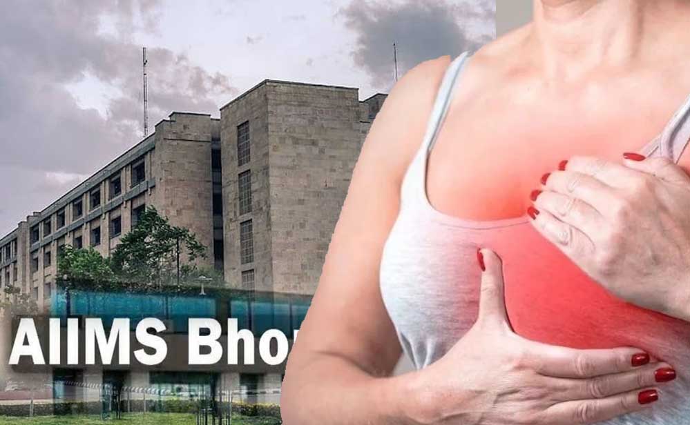 स्टेज-4 ब्रेस्ट कैंसर में नई दवाओं से बढ़ी उम्मीद, एम्स में मरीजों के इलाज के बेहतर विकल्प