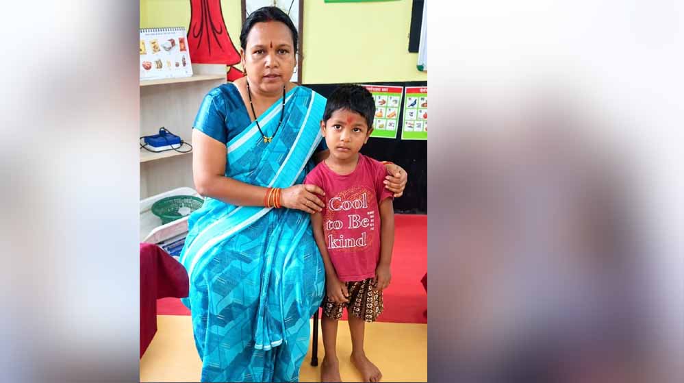 चिरायु से मिली नई उड़ान- नन्हें सूर्या के टेढ़े पैरों को मिली राह