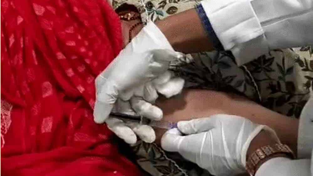 इंदौर के MY अस्पताल में फ्री बोटोक्स ट्रीटमेंट, लकवे से जकड़े अंगों को मिल रही नई जिंदगी